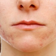 hannah-story-190x190