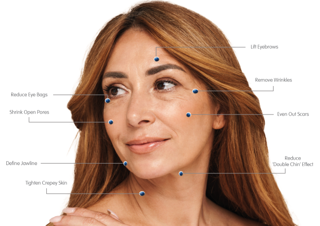 Focus Dual Lady – Treatment Areas Labelled