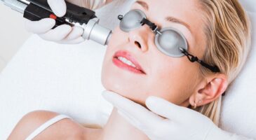 Motus-Moveo-Laser-Hair-Removal-Facial-Treatment